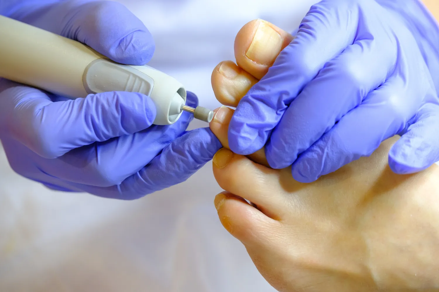 Pedicure leczniczy - czym jest i co warto wiedzieć na jego temat?