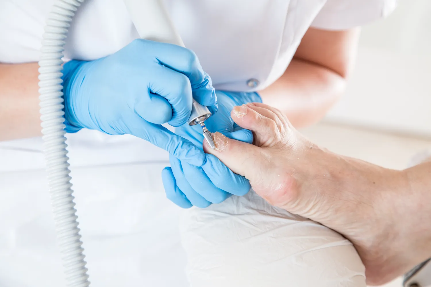 Pedicure leczniczy